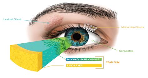 Meibomian Gland Dysfunction Oil Deficiency Dry Eye Ocular Surface Hot