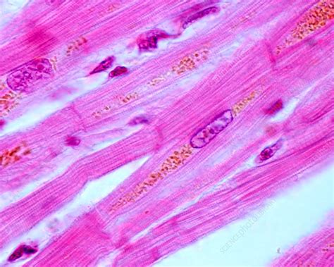 Heart Muscle Cells Light Micrograph Stock Image C0361292