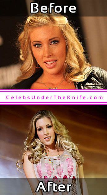 Samantha Saint Pornstar Plastic Surgery Photos