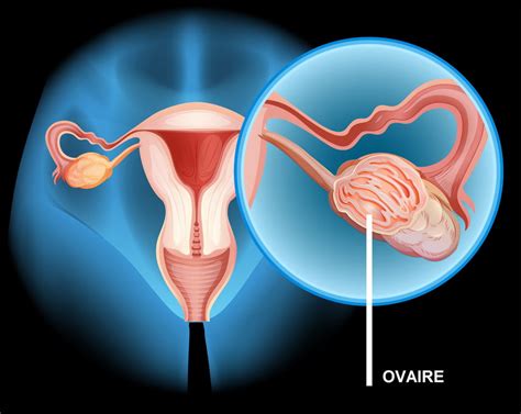 Mal Au Ovaire Quand Je Tousse - Mal aux ovaires : règles, ovulation, rapport, quelle cause