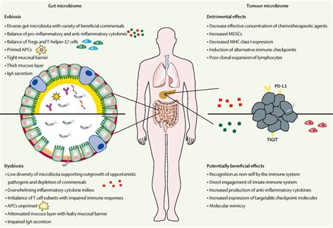 Modulating The Microbiome To Improve Therapeutic Response In Cancer