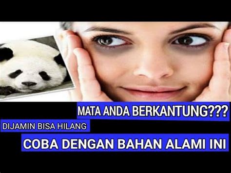 #winchan#matapanda cara mengobati mata panda secara alami ...