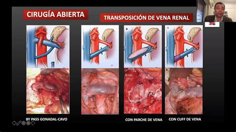 Simple Science: How to Make a Volcano with Kids
