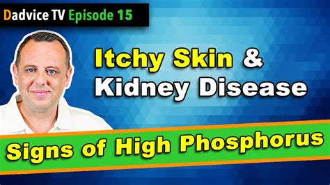 Can Kidney Disease Cause Itching Captions Quotes