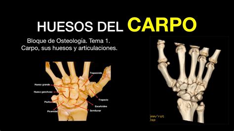 Huesos Del Carpo De La Mano Anatomia Youtube