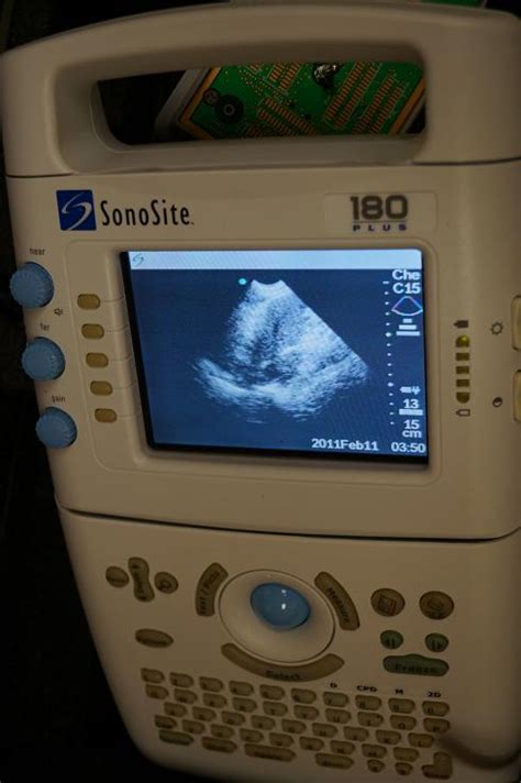 Sonosite 180 Plus Portable Ultrasounds For Sale Used Hospital Medical