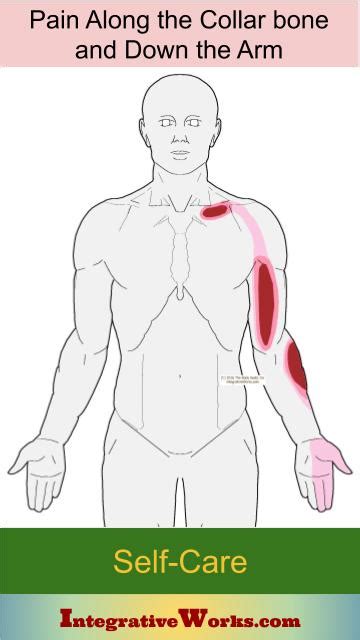 Torso Into Arm Pain Patterns Causes Self Care Integrative Works