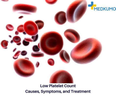 Low Platelet Count Low Platelet Count Causes Symptoms A Flickr