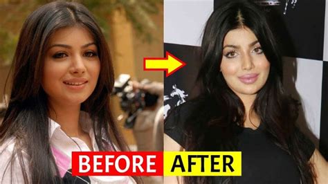 Top 10 Bollywood Actresses Who Looks Horrible After Plastic Surgery