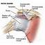 Rotator Cuff Injury Causes Symptoms Treatment
