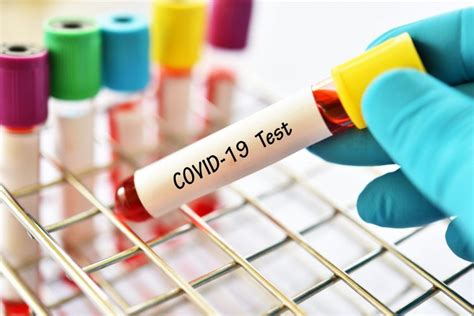 Free covid testing is available in most communities. Developing a COVID-19 testing kit using RNA detection