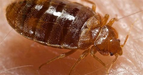 Bed Bug Bites Top Things To Know About