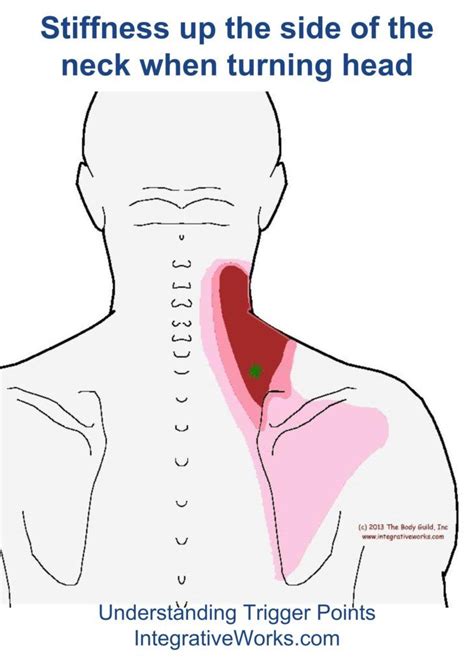 Back Shoulder Pain Diagnosis Chart