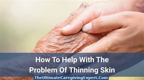 Help Problem Thinning Skin Youtube