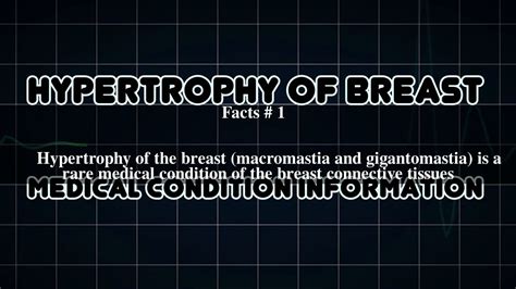 hypertrophy of breast top 5 facts youtube