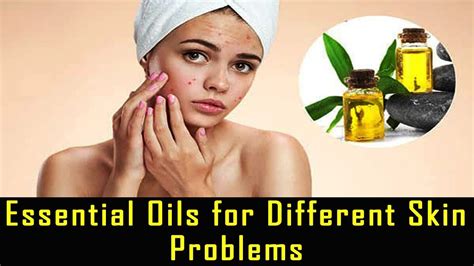 Essential Oils For Different Skin Problems Best Treatment For Skin