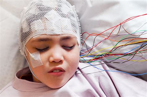 Electroencephalogram Eeg The Defeating Epilepsy Foundation