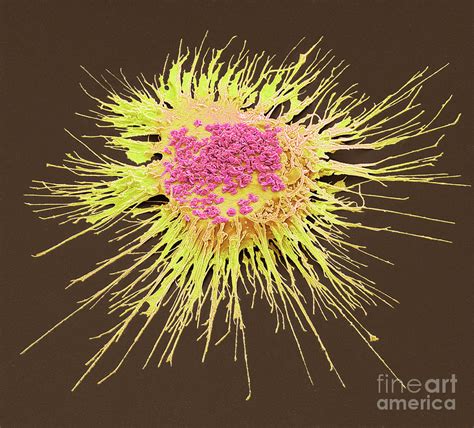Mycoplasma Photograph By Steve Gschmeissnerscience Photo Library