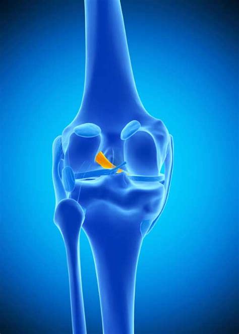 Acl Insufficiency Anterior Knee Instability Knee Instability
