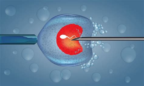 Icsi Intracytoplasmic Sperm Injection World Leading Fertility Clinic In Bangkok