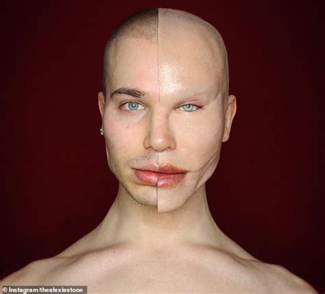 News Pictures — Drag Artist Fakes His Plastic Surgery Transformation