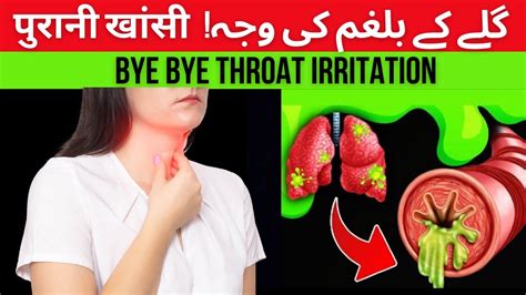 2 Causes Of Phlegm Stuck In Throat Phlegm In Throat गले में थूक