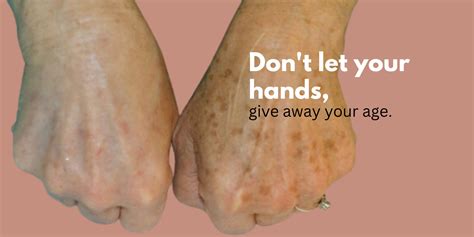 are your hands giving away your real age glow luxe skincare and medispa