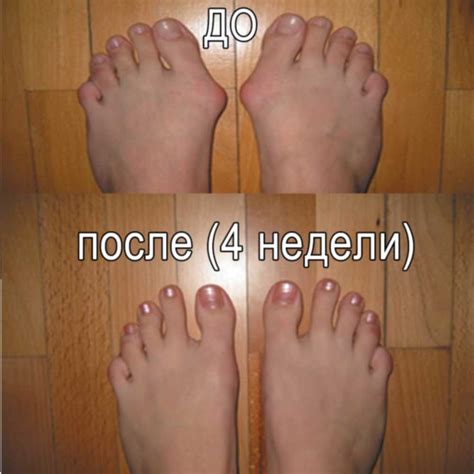 Правильные Пальцы На Ногах Фото Фото Картинки