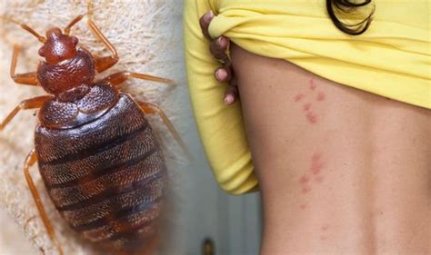 Bed Bug Bites How To Avoid Them And Get Rid Of An Infestation Be