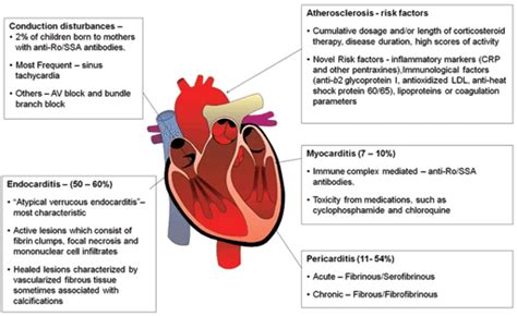 Pathogenesis And Manifestation Of Cardiac Dysfunction In Systemic Lupus