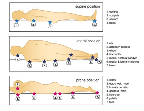 Jan Interactive Pressure Ulcer Risk Assessment