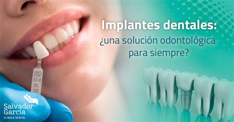 Implantes Dentales ¿una Solución Odontológica Para Siempre