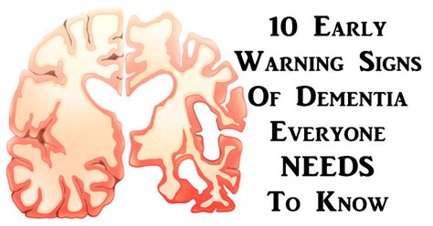 10 Early Warning Signs Of Dementia Everyone Needs To Know