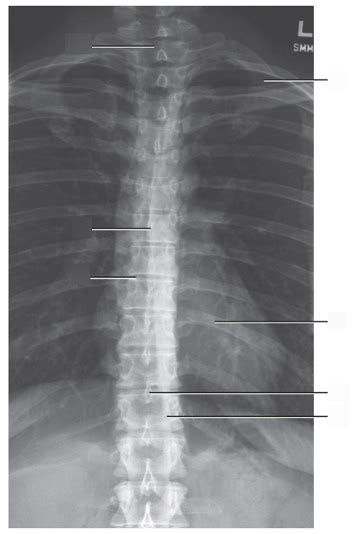 Ap Thoracic Spine Labeling Diagram Quizlet