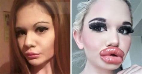 Who Is Andrea Ivanova Woman With Biggest Lips Ig Age Bio