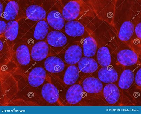 Stem Cells Of A Lentil Plant Under The Microscope Royalty Free Stock