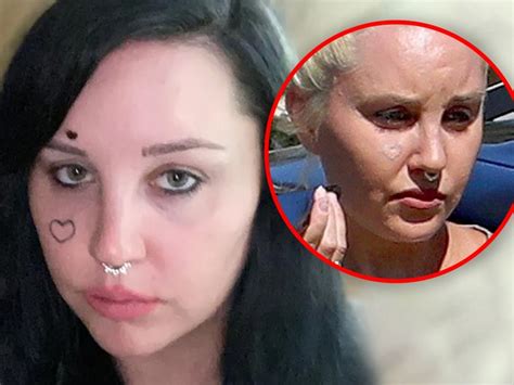 Amanda Bynes Appears To Be Removing Face Tattoo After Mental Health Center Check In Hollywood