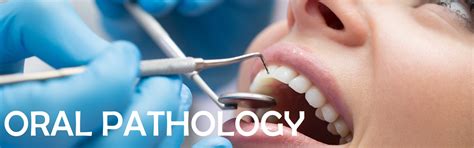 させていた Oral Pathology For The Dental Hygienist， 6e並行輸入 1455703702