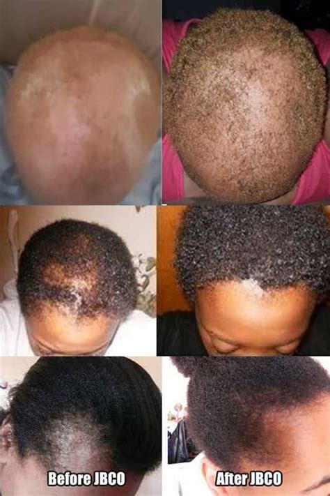 30 Castor Oil Hair Growth Before And After Pictures Fashionblog