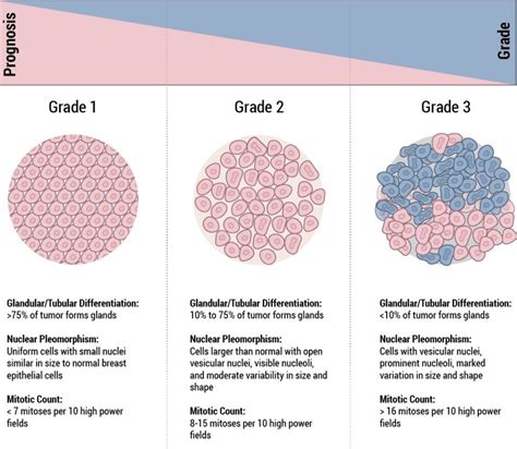 Staging And Grade Breast Cancer Johns Hopkins Pathology