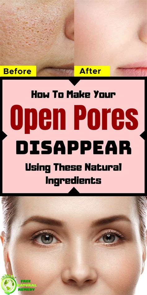 Effective Ways To Shrink Pores Naturally At Home Shrink Pores