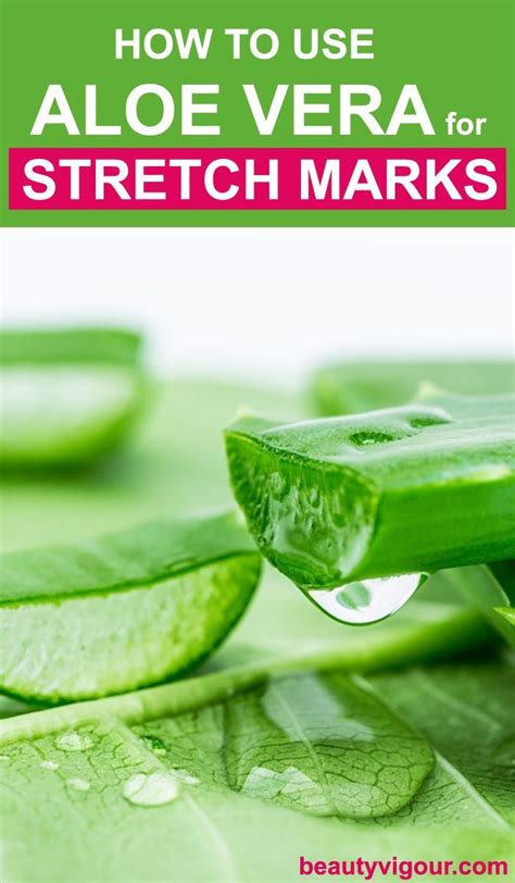 How To Use Aloe Vera For Stretch Marks FrenchBeautyRoutine Stretch