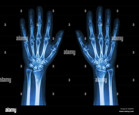 X Ray Anatomy