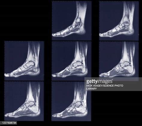 Foot And Ankle Anatomy Stock Fotos Und Bilder Getty Images
