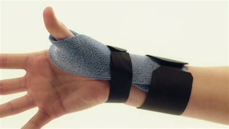 Orthosis For De Quervains Tenosynovitis Orficast Instructional Movie Orthosis Hand