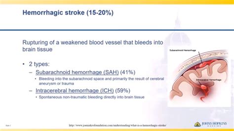 Both cause parts of the brain to stop functioning properly. Hemorrhagic Stroke | Lisa Klein - YouTube