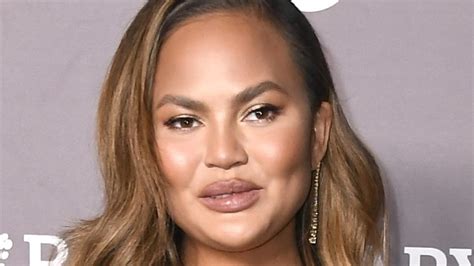 Chrissy Teigen Shares Instagram Photo Of Surgery Scars After Breast Implant Removal