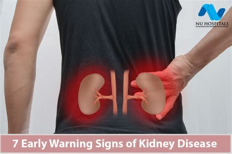 7 Early Warning Signs Of Kidney Disease