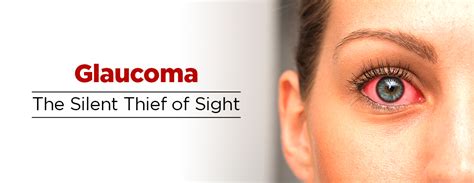 Glaucoma The Silent Thief Of Sight Memon Medical Institute Hospital