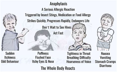 Examples include reactions to certain foods or particular insect stings. Anaphylaxis in Children: Field Management